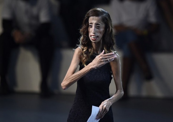 Lizzie Velasquez